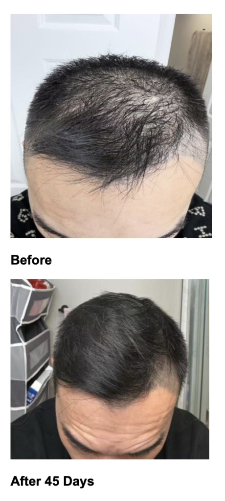 Before and After Vantis Conditioning Fluid