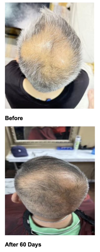 Before and After Vantis Conditioning Fluid